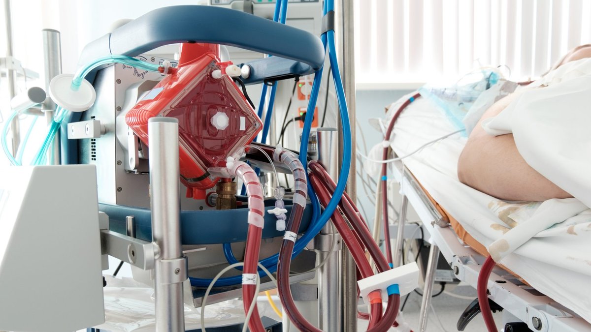 ECMO Life Support